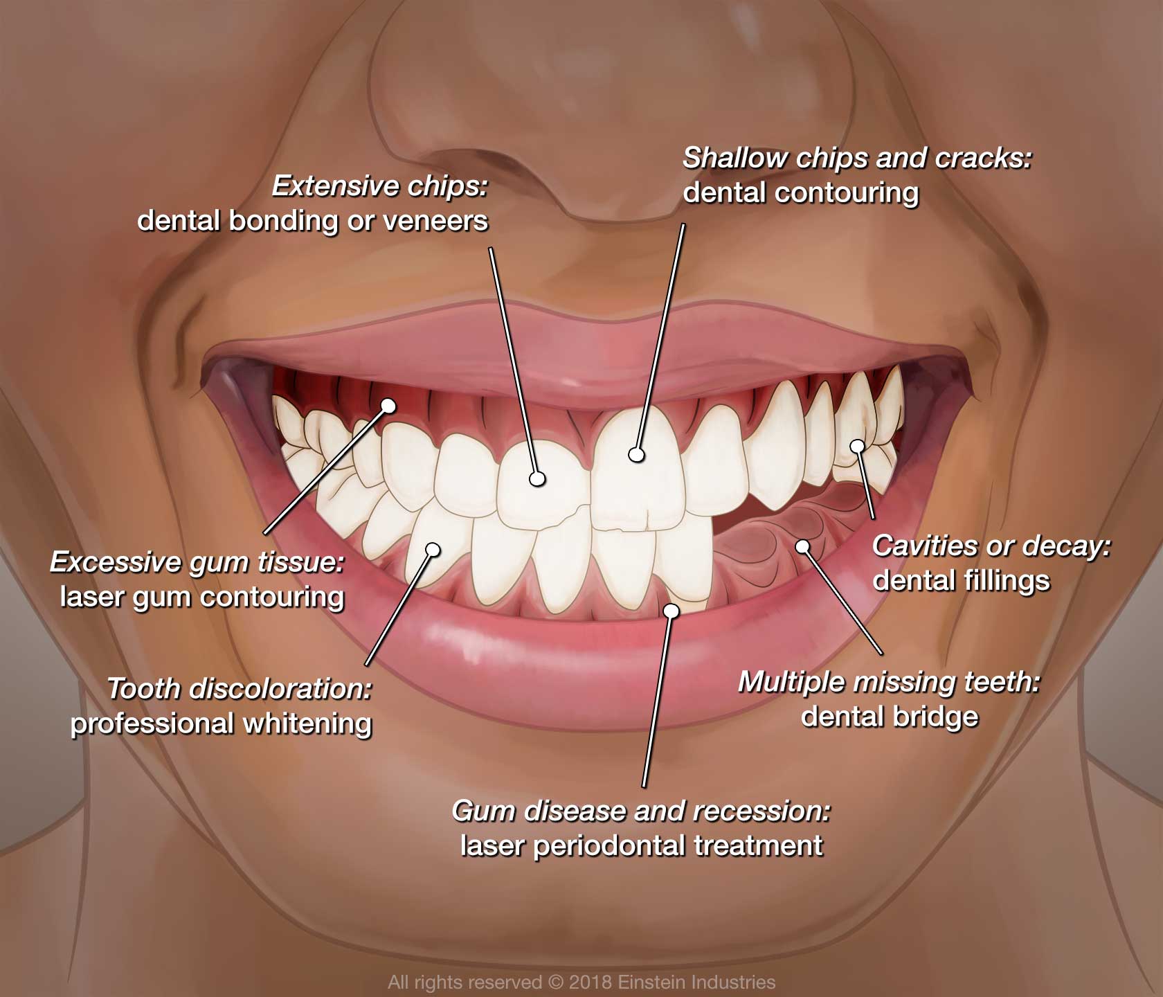 smile makeover options illustration