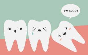 Wisdom tooth eruption and pericoronitis illustration